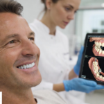 best full mouth dental implants​
