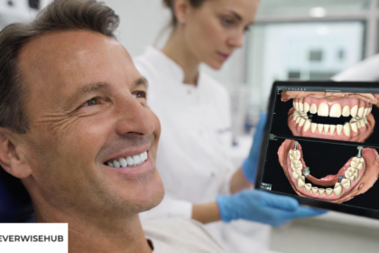 best full mouth dental implants​