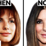 sandra bullock plastic surgery​