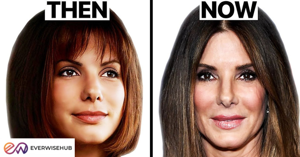 sandra bullock plastic surgery​